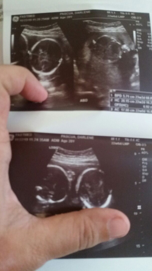 darlene pascua profile icon