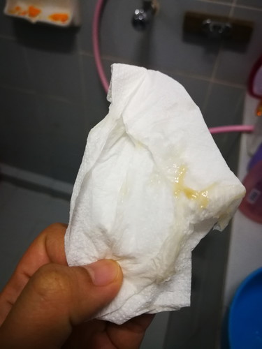 มูกเตือนใกล้คลอด