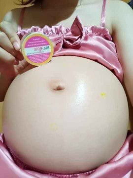 Kem Mul rose trị rạn da