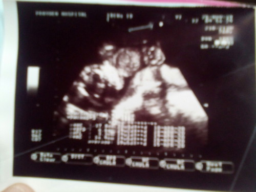 เเม่ดูเพศไม่ออก ?