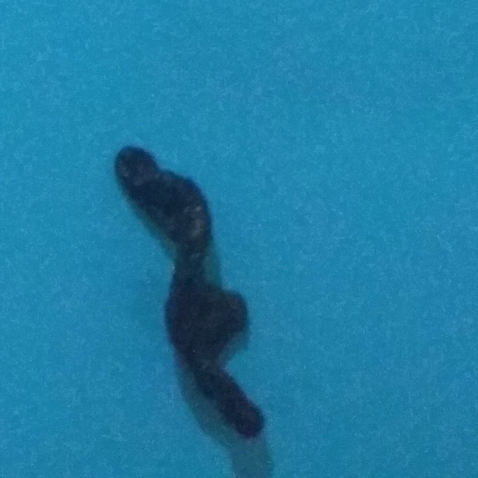 Gumpalan Seperti Daging