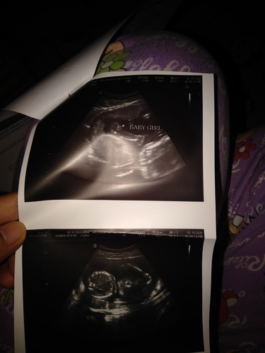 Baby Girl ?