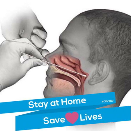 swab test