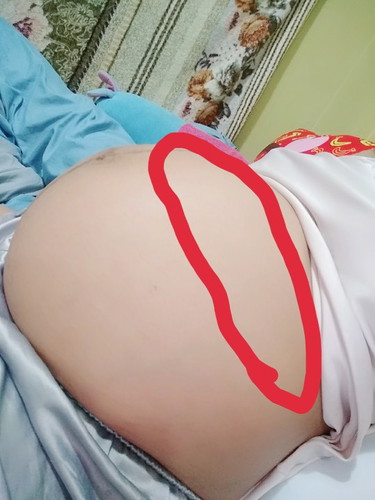 ปวดท้อง