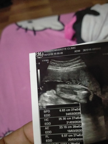 ได้ลูกสาวสมใจค่ะ?