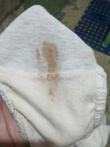brown discharge
