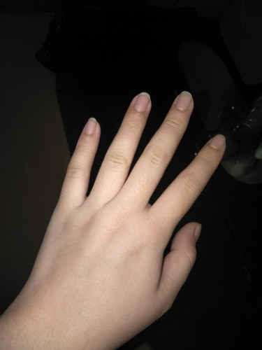 masakit na kamay