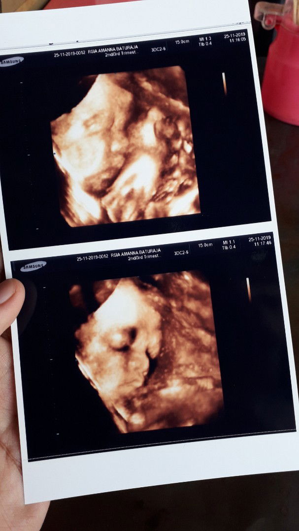 Mendekati proses persalinan