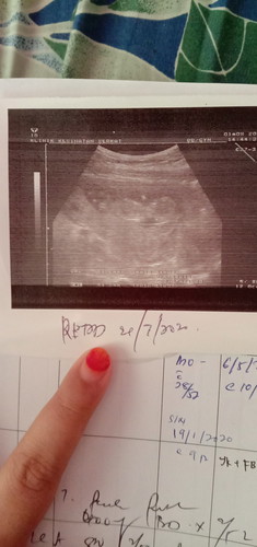 Baby kecik n HB blood low ~
