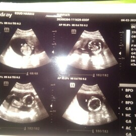 menunggu mantul2 ya dede