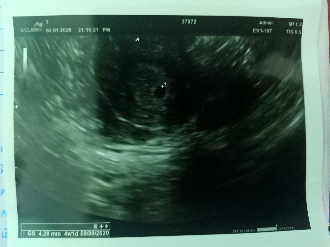 ซาวด์ครั้งแรก