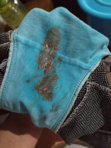 discharge with blood