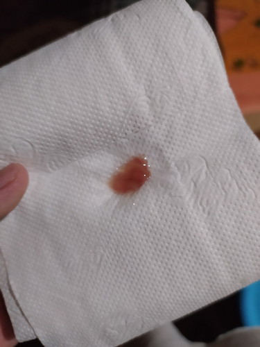 mucus plug
