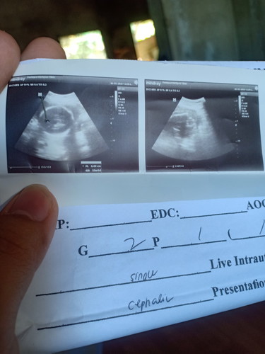 ultrasound