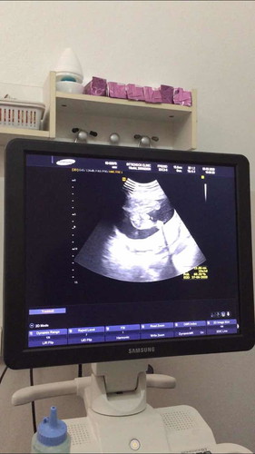 เพศลูก