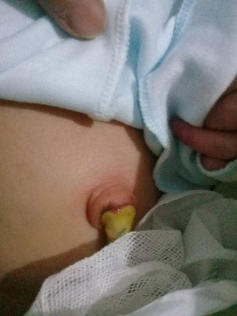 tali pusat