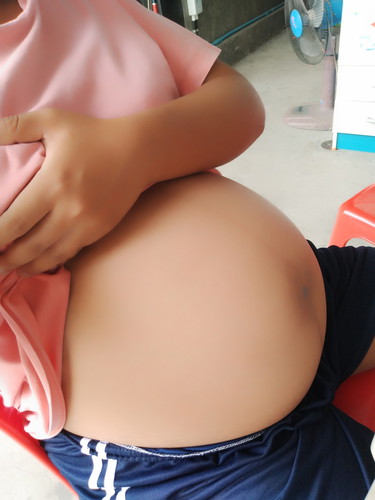 ท้องปันบ่อยตั้งแต่เมื่อคืน