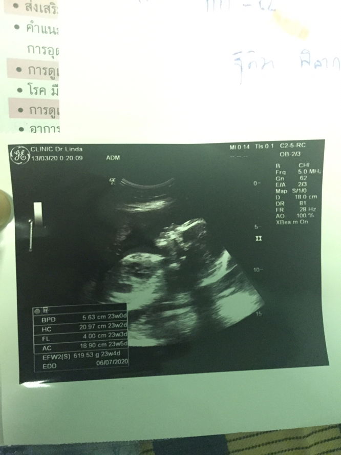 สอบถามคะพอดีน้ำหนักลูกเกินจะเสี่ยงเป็นเบาหวานไหมคะ?