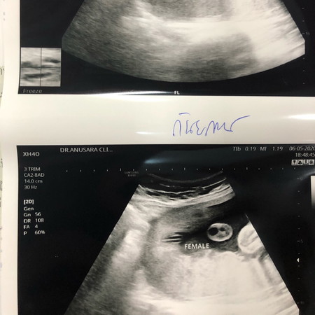 คุณหมอบอกว่าน้องเพศหญิง