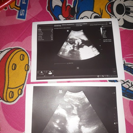 my baby gender