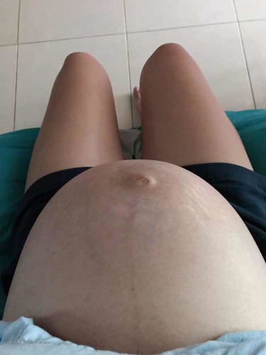 37weeks แล้ว ตื่นเต้นจัง