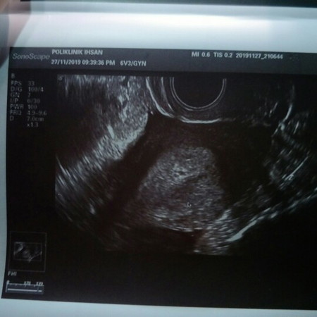 4 week