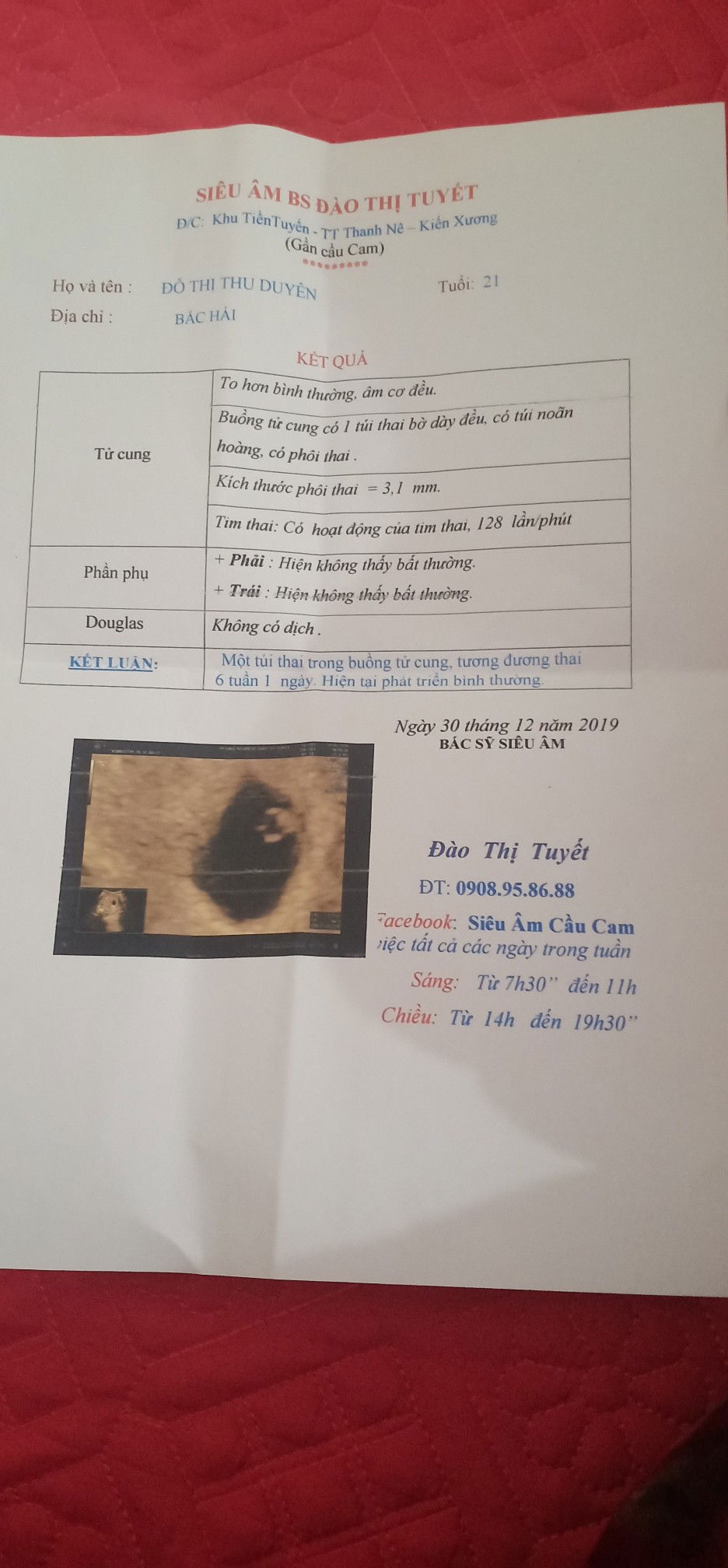 các mon có kinh nghiệm cho e hỏi ntn là bình thường chưa ạ.