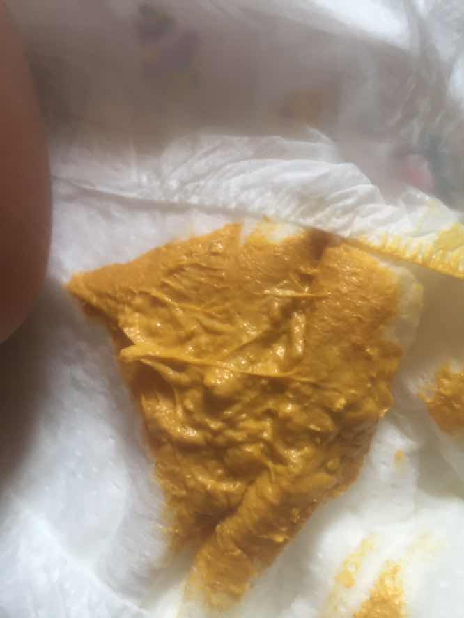 อึลูกเหนียวมากค่ะ