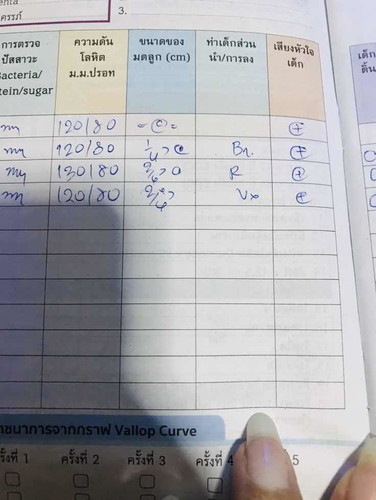 Vx คืออะไรคะ