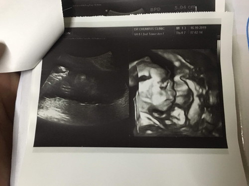 รบกวนสอบถามแม่ๆค่ะ