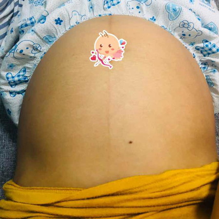 ทีมเดือนสิงหาคม