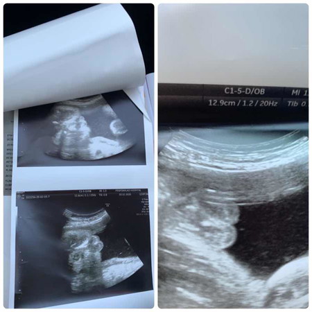 แม่ๆทราบไหมคะว่าเพศอะไร