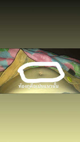 ท้อง