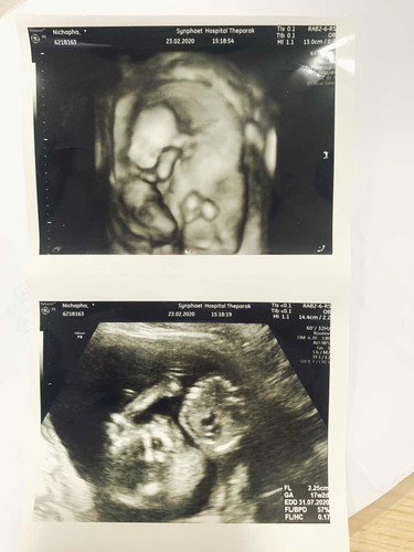 17 w คะ มีใครได้ลูกสาวบ้างเอ่ย