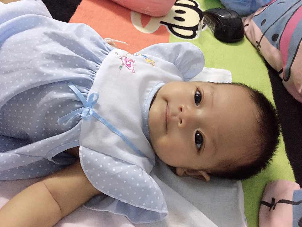 หายใจคลืดคลาด