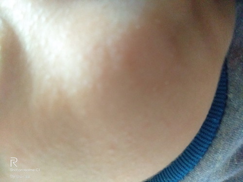 ใช่กากน้ำนมมั้ย