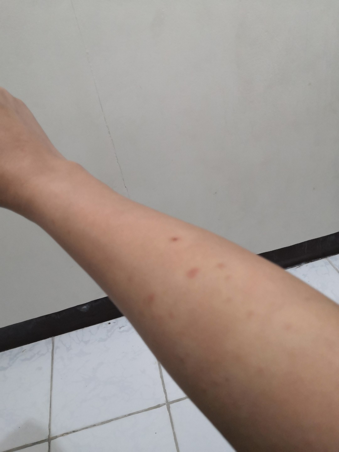 Rashes