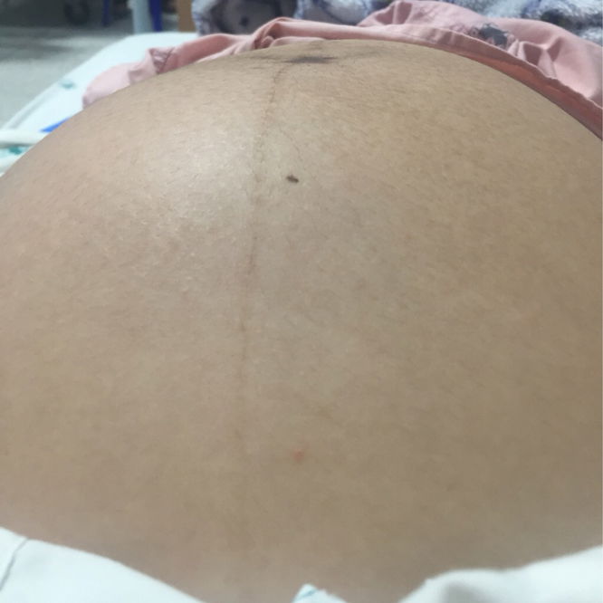 ท้องปั้นกันบ้างมั้ยคะ