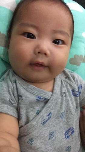 ลูกหน้าแตกมีครีมอะไรแนะนำไหมค่ะแม่แม่
