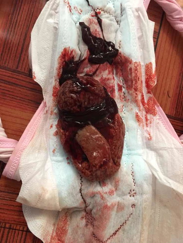 ถ้าออกมาแบบนี้เค้าเรียกว่าอะไรค่ะ