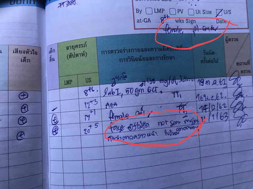 สงสัย