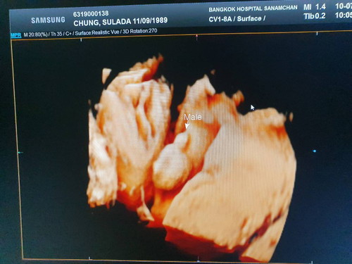 ผมลูกพ่อนะครับ