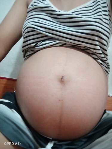 35wแล้วมีแต่คนทักว่าท้องเล็ก