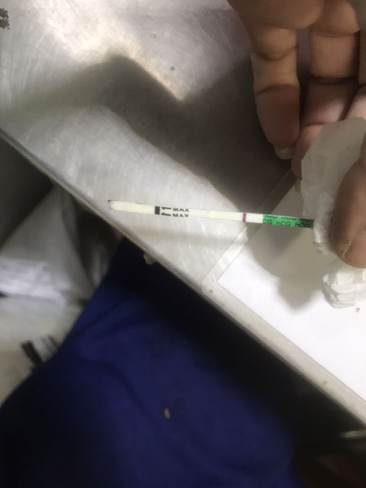 ครวจครรภ์