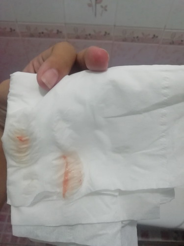 แบบนี้ควรไปหาหมอมั้ยค่ะ