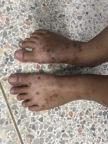 สอบถามหน่อยค่ะ ตั้งครรภ์ 18 w 2 d