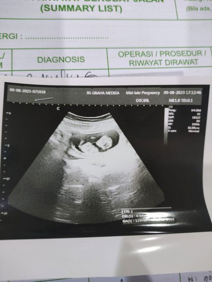 Siti Amelia profile icon