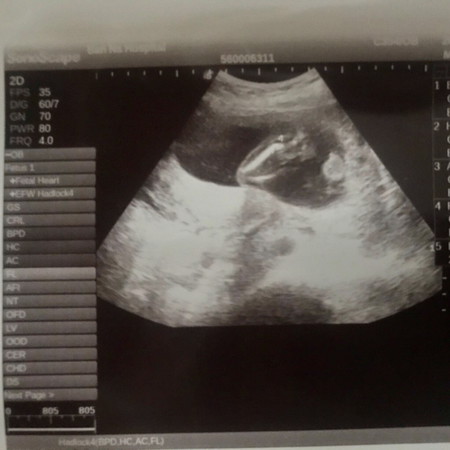 ผลซาวด์ล่าสุด