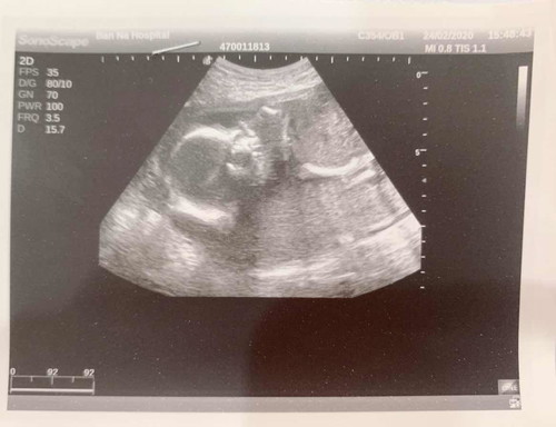 ตั้งครรภ์