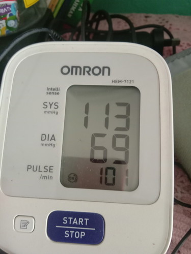 Degupan Jantung Laju